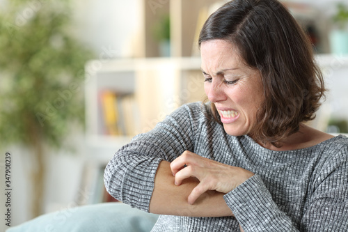 Fotografi Middle age woman scratching itchy skin at home