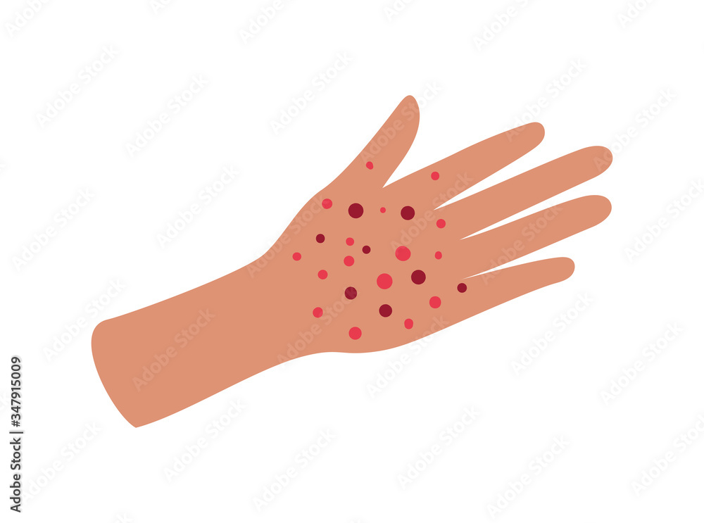 Hand with covid 19 virus vector design Hand with covid 19 virus vector design