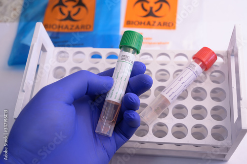covid 19 specimen collection kit