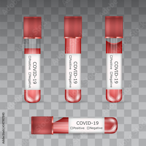Covid-19 blood test tubes isolated on transparent background. Coronavirus laboratoty research symbol, 3d medical glassware with result checkboxes on the paper label to show if a person is sick or ok.