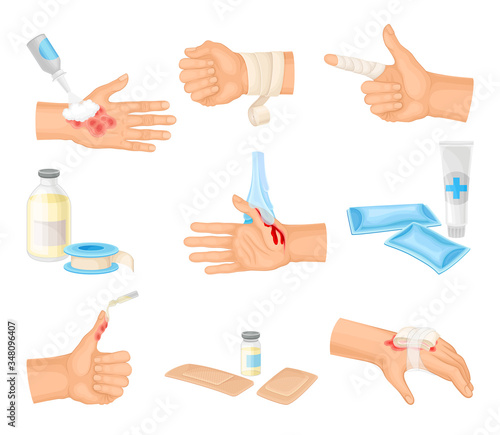 Hands with Injured Skin and Procedures of Bandaging and Wound Cleaning Vector Set