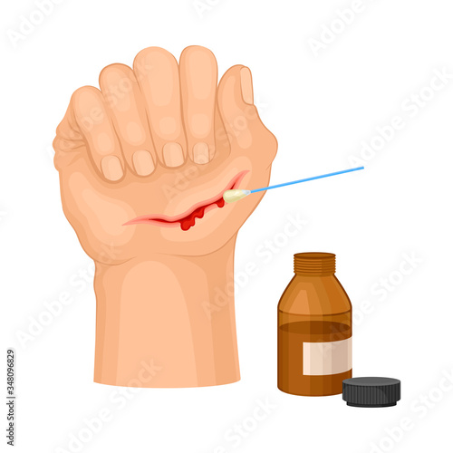 Hand with Wound Streaming Blood Cleaning with Pharmaceutical Substance Procedure Vector Illustration