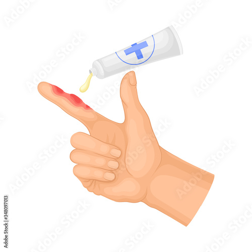 First Aid for Hand with Ambustion or Burn on the Skin Vector Illustration