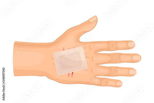 Hand Wound or Cut with Medical Patch Vector Illustration