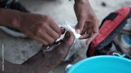 Female medics hands wiping and cleaning foot injury with cotton wool photo