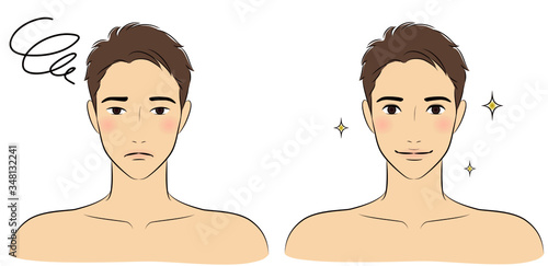 Double eyelid surgery before and after vector illustration for men.