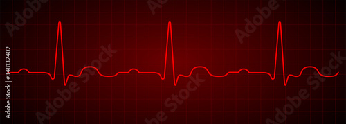 Heartbeat line. Red electrocardiogram. Vector pulse line. Medical cardiogram on grid background.