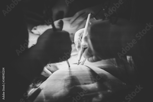 Cuadro en lienzo Doctors performing a caesarian section in an operating theater in a hospital