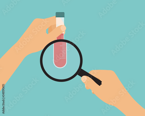 Flat design cartoon illustration of scientist or doctor hand with test tube full of blood for analysis with magnifying glass, vector