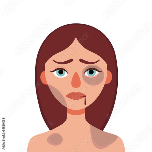 Sad young woman with bruises and wounds on a white background.Concept of domestic violence, sexual abuse in the family, bullying, social problem, aggression against women.Vector cartoon illustration