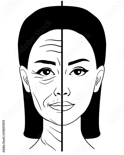aging