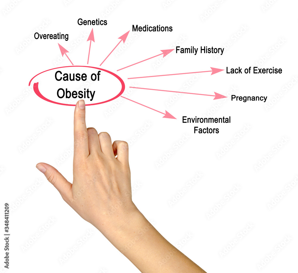 Presenting Seven Causes of Obesity. Presenting Seven Causes of Obesity.