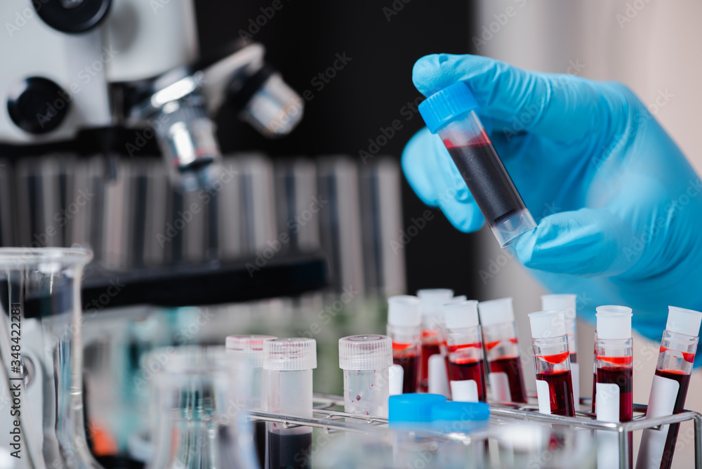 doctor or scientist hand pickup blood test tube from rack doctor or scientist hand pickup blood test tube from rack