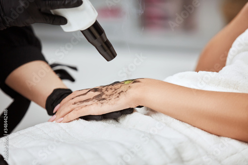 close-up of female arm with carbon mask receiving laser theraphy in beauty clinic