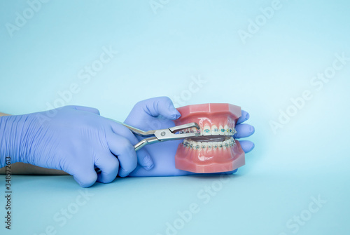 Metal braces for teeth and tools for correction of brace systems. Dental tools for the orthodontist. Correction of a smile at an orthodontist.The doctor holds a jaw with braces in his hands