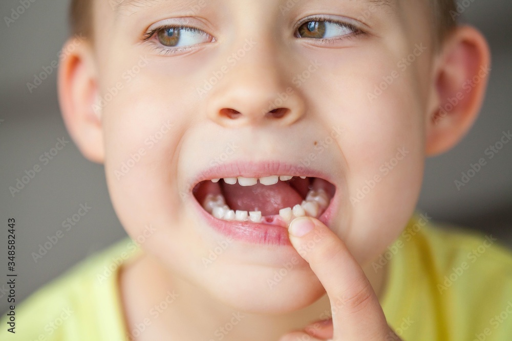 The child dropped the first milk tooth. Happy little boy and milk tooth. The child dropped the first milk tooth. Happy little boy and milk tooth.