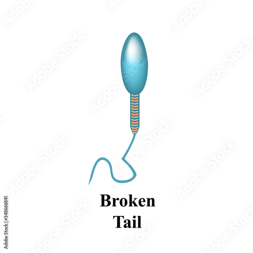 Pathological forms of sperm in the ejaculate. Male infertility Oligospermia. Spermogram. Sperm defects. Infographics. Vector illustration on isolated background.