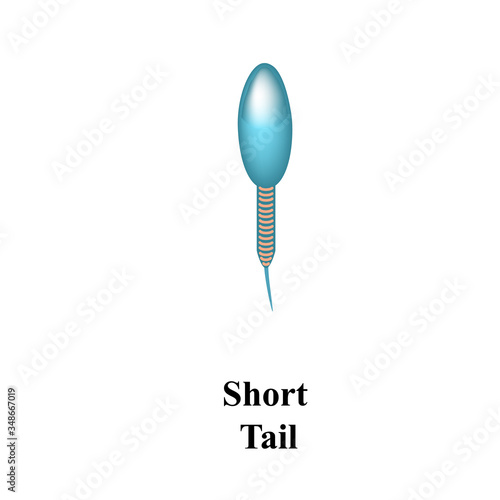 Pathological forms of sperm in the ejaculate. Male infertility Oligospermia. Spermogram. Sperm defects. Infographics. Vector illustration on isolated background.