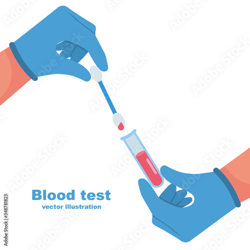 Doctor hold in hand sample blood in test tube. Laboratory research. Vector illustration flat design. Equipment for analysis. Blood donation. Coronavirus covid-19 test. Template medical landing page.