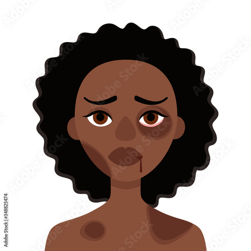 Sad african woman with bruises and wounds on a white background.Concept of domestic violence, sexual abuse in the family, bullying, social problem, aggression against women.Vector cartoon illustration