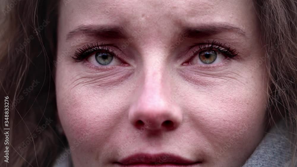 Women smiling watching in different directions, different eye colors, Heterochromia Women smiling watching in different directions, different eye colors, Heterochromia