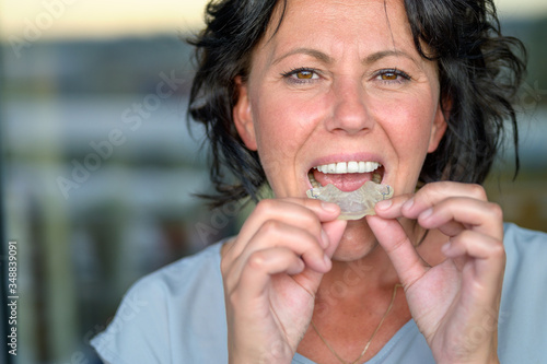 Woman with bruxism holding a mouth guard
