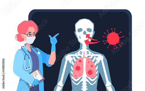 A doctor showing how coronavirus molecules infect a person on an x-ray image. Damaged lungs infographic. COVID-19 contamination process. Human anatomy, skeleton. A vector cartoon illustration.