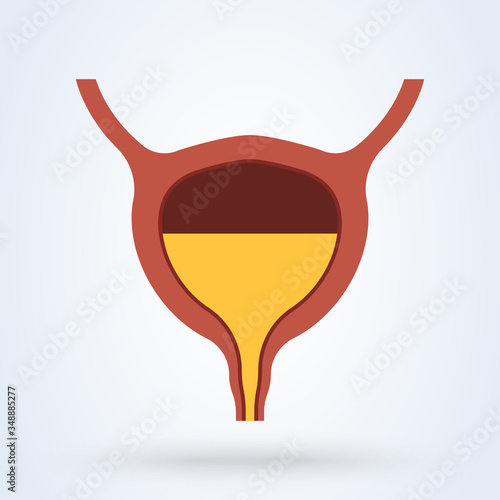 Full Urinary bladder. Human organ anatomy. Medical, healthcare and scientific concept. Vector illustration