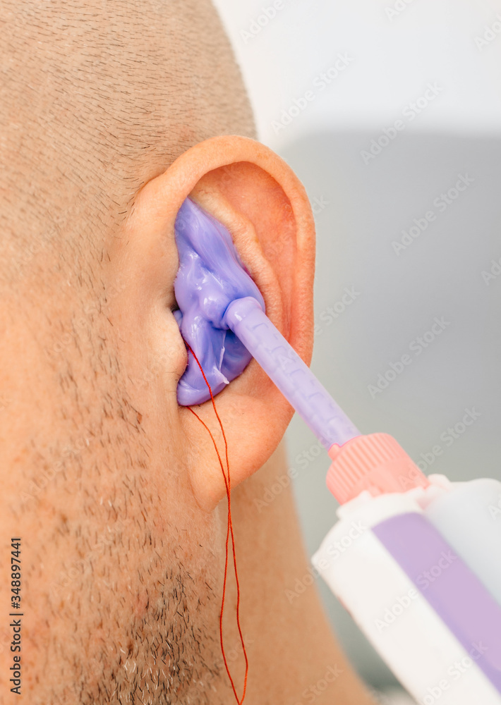 Process of making earplug from an impression of an individual’s human ear. Ear close-up. Personally molded earplugs. Solution for noisy places. Part of the set Process of making earplug from an impression of an individual’s human ear. Ear close-up. Personally molded earplugs. Solution for noisy places. Part of the set