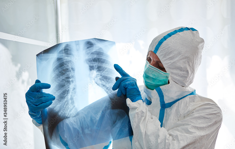 Radiologe betrachtet Röntgenbild von Lunge eines Covid-19 Patient Stock ...