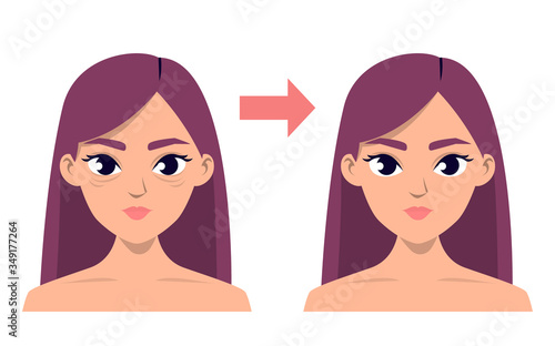 Blepharoplasty before and after vector isolated. Medical