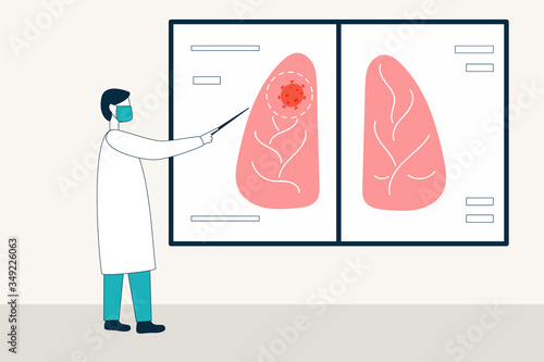 A doctor in a uniform and a medical mask points to an inflammation site on an X-ray of the lungs. Viral pneumonia