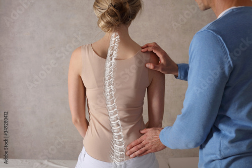 Scoliosis Spine Curve Anatomy, Posture Correction. Chiropractic treatment, Back pain relief. photo
