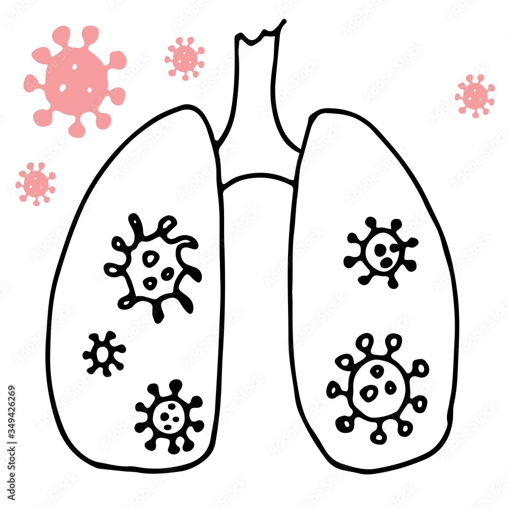 Illustration of lungs susceptible to the virus. Drawing. Illustration of lungs susceptible to the virus. Drawing.