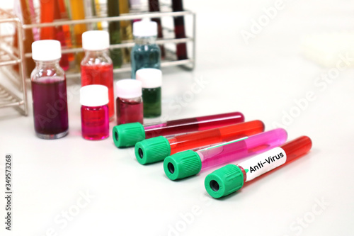 The testing or investigating of vaccine to inhibit the coronavirus (COVID-19) clinical trial phase in vitro microbiology laboratory, blood reagent experiment for Anti-virus cause of disease spreading.
