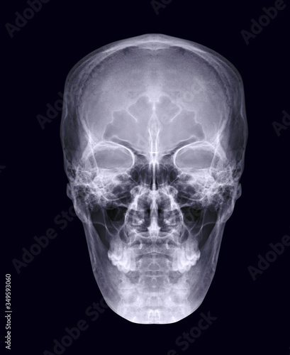  Skull x-ray image of Human skull AP or front view isolated on Black Background. clipping path.