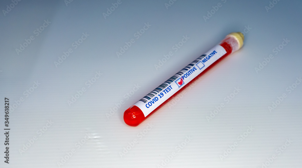 Test tube with blood inside and marker of a covid 19 positive result. Blood sample of a covid 19 patient inside a test tube with a positive result. Test tube with blood inside and marker of a covid 19 positive result. Blood sample of a covid 19 patient inside a test tube with a positive result.