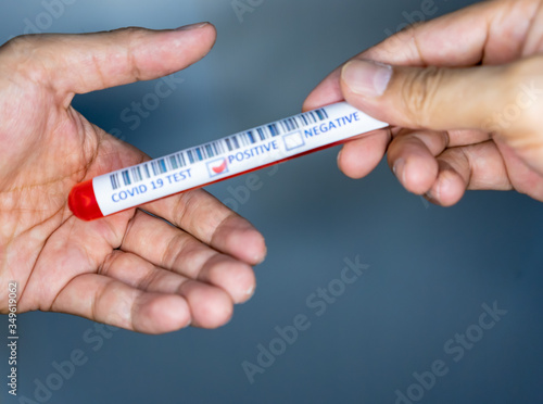a test tube with blood inside with covid 19 infection positive result while being hand over to another person.