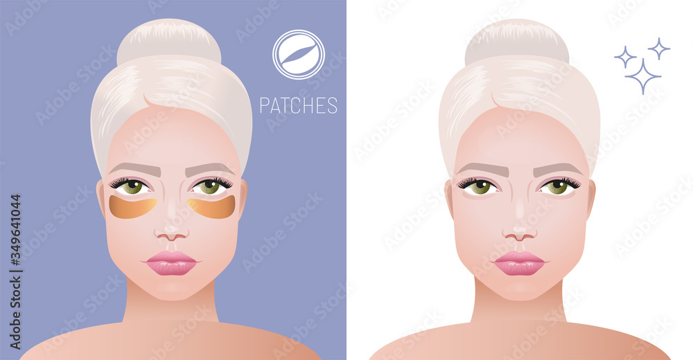 Cosmetic gold eye patches. Beautiful face of a woman with hydrogel gold patches under her eyes taking care of the skin. Express cosmetics. Vector realistic illustration. Cosmetic gold eye patches. Beautiful face of a woman with hydrogel gold patches under her eyes taking care of the skin. Express cosmetics. Vector realistic illustration.