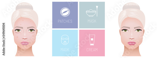 Treatment beauty. Problems on the skin pimples and acne, and dark circles under the eyes. Types of cosmetics masks, patches under the eyes and cream. Vector realistic illustration.	
