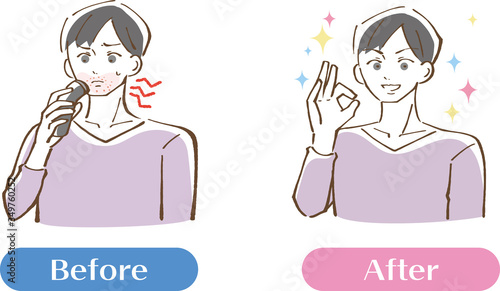 シェイバーで肌が炎症を起こしている男性ビフォーアフターセット　イラスト