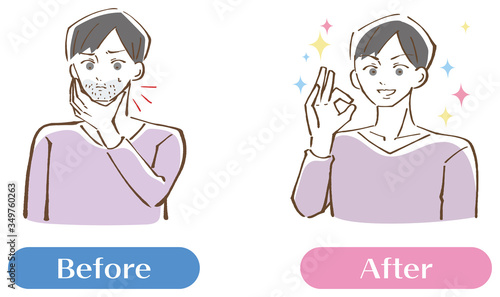 青髭が生えている男性ビフォーアフターセット イラスト Stock Vector Adobe Stock 青髭が生えている男性ビフォーアフターセット イラスト Stock Vector Adobe Stock