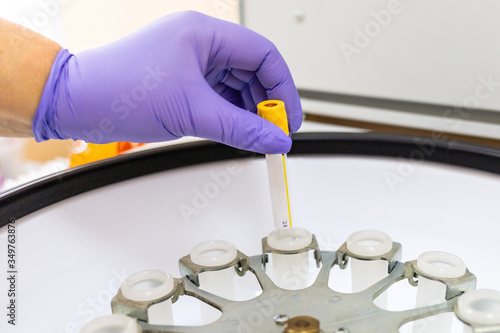 Covid-19. A worker in medical gloves puts a sample in a laboratory centrifuge, close-up. Concept of scientific and medical research