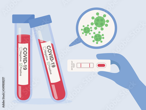 Hand of doctor holding a test kit for viral disease COVID-19 with a Patient blood sample in a glass tube. Lab card kit test for Coronavirus. Test Result on label is positive.