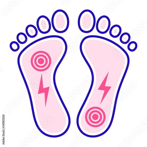 Acute pain foot color line icon. Sprain, injury. Isolated vector element. Outline pictogram for web page, mobile app, promo.