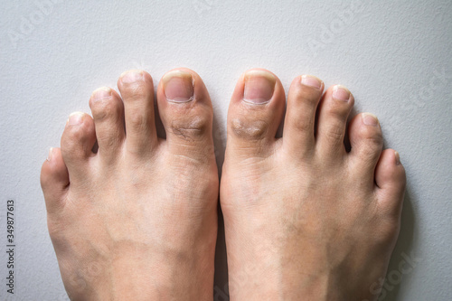 The foot and long nail toes on white concrete background. Long nails and dirty may cause fungal.