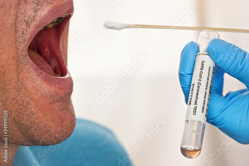 Fotografie Stick with cotton swab to be inserted into elderly patient open mouth, tube for virus specimen transport held by hand in blue glove near, closeup detail