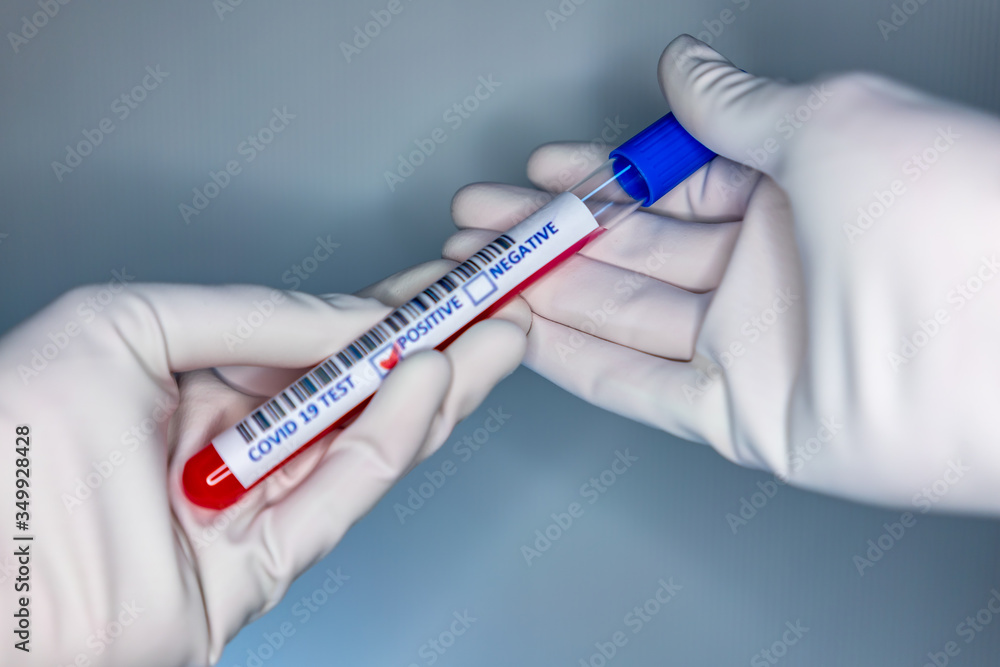 Obraz premium Blurry image of a nurse hands while holding a test tube containing a patient’s sample that has tested positive for coronavirus