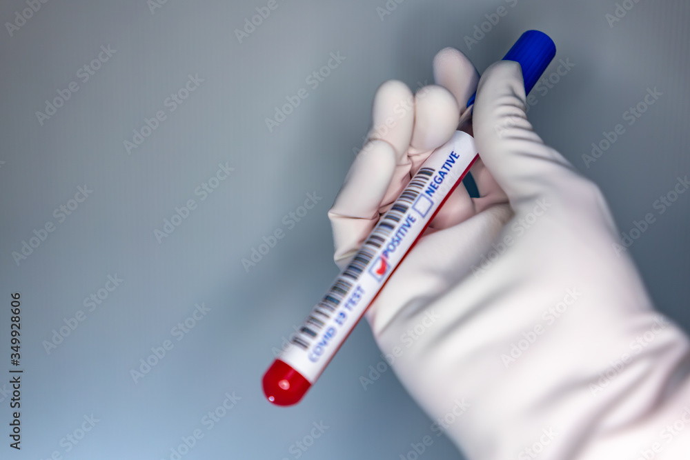 Naklejka premium Blurry image of a nurse hands while holding a test tube containing a patient’s sample that has tested positive for coronavirus