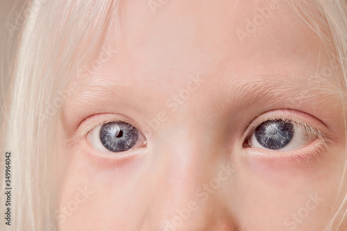 close-up photo of albino child eyes, little girl with unusual eyes, hair, eyebrows and lashes color. natural beauty, albinism concept
